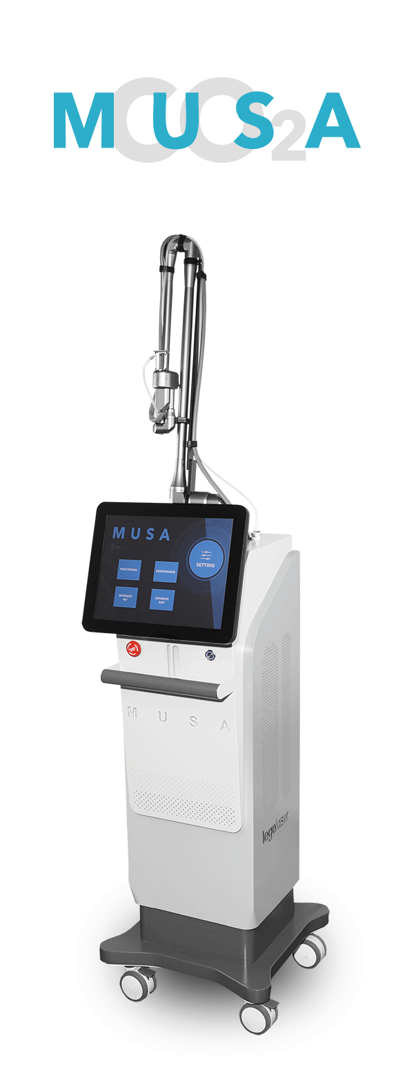 musa_3posiciones_gif musa