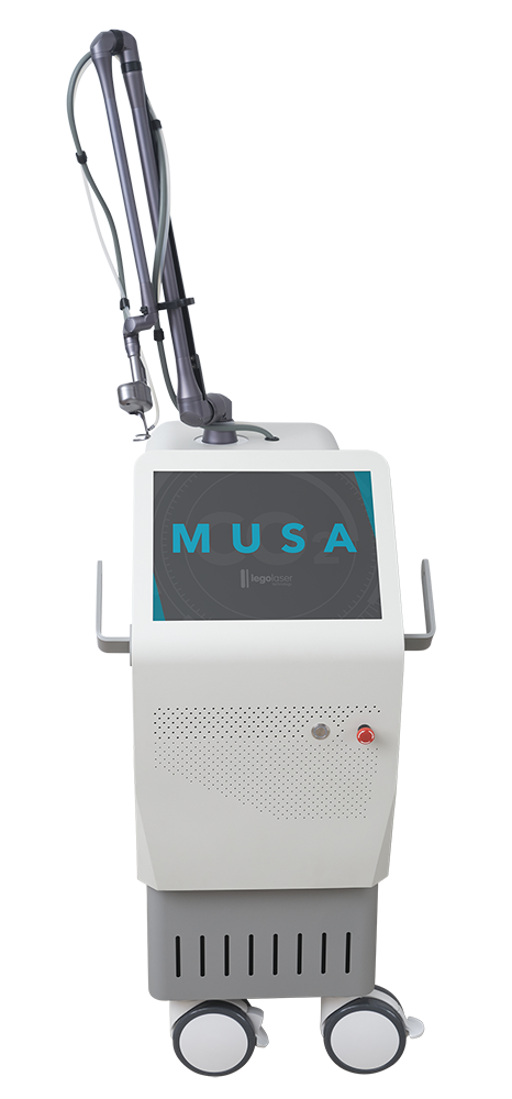 musa_small musa