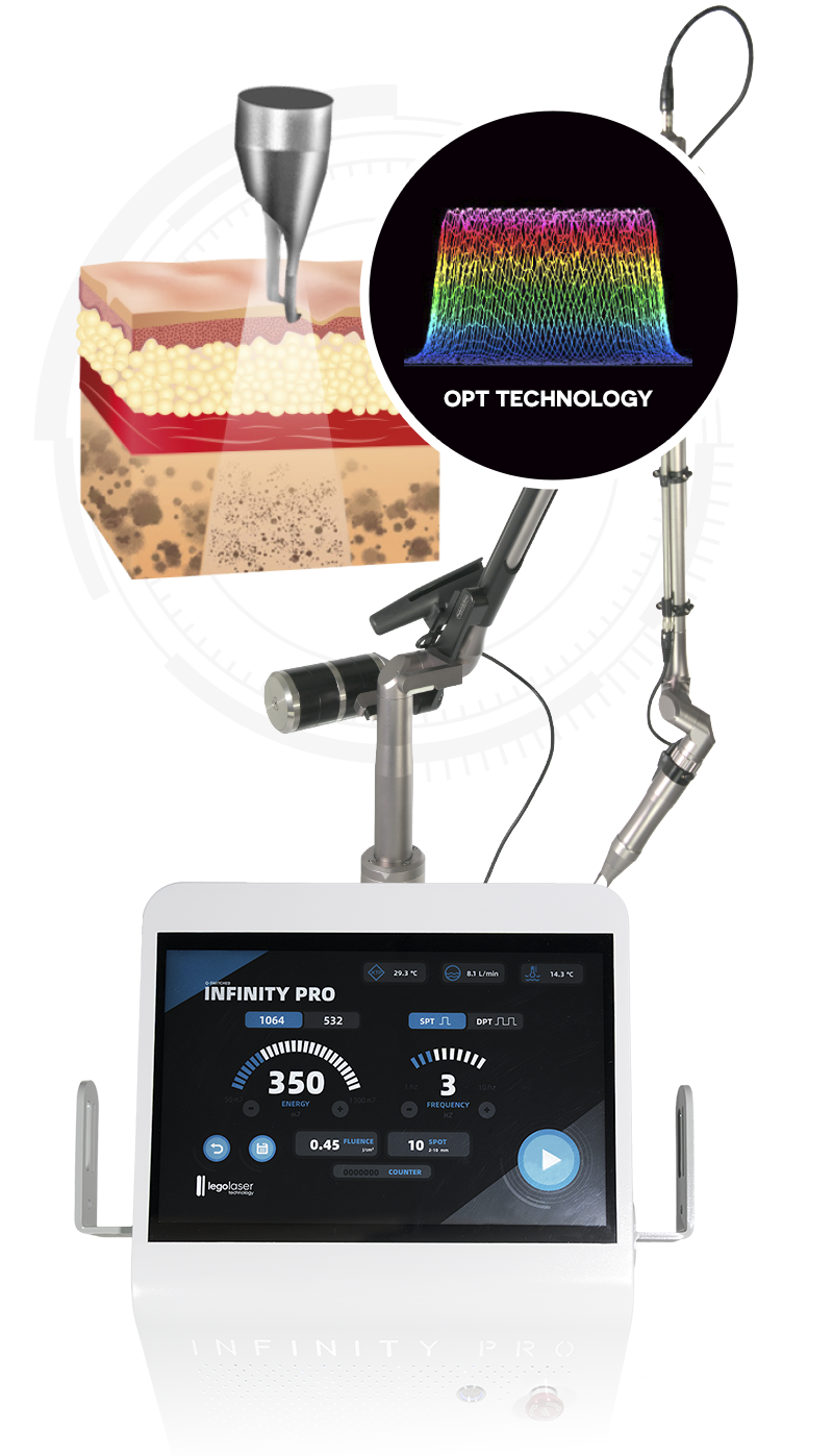  Technical Features